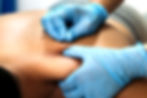 Dry Needling: Rumpf und Kopf  | Aufbaukurs
