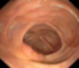 ree