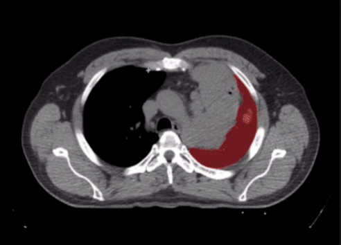 LLM Medical.gif