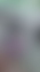 Why You Shouldn’t Run on Concrete: Better Surfaces for Knees