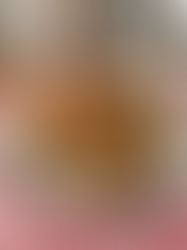 The Ultimate Healthy Creamy Garlic Mushrooms on Toast: A Deep Dive into Guilt-Free Indulgence