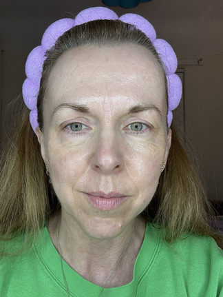 4 weeks using Renew + Me