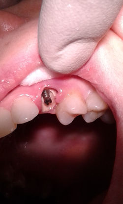 Терапевтическое лечение