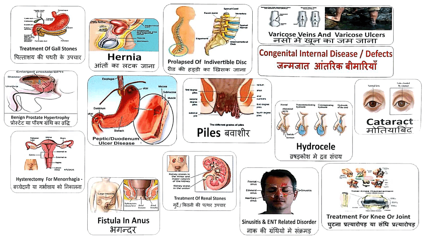 waitinf-period-surgeries.gif