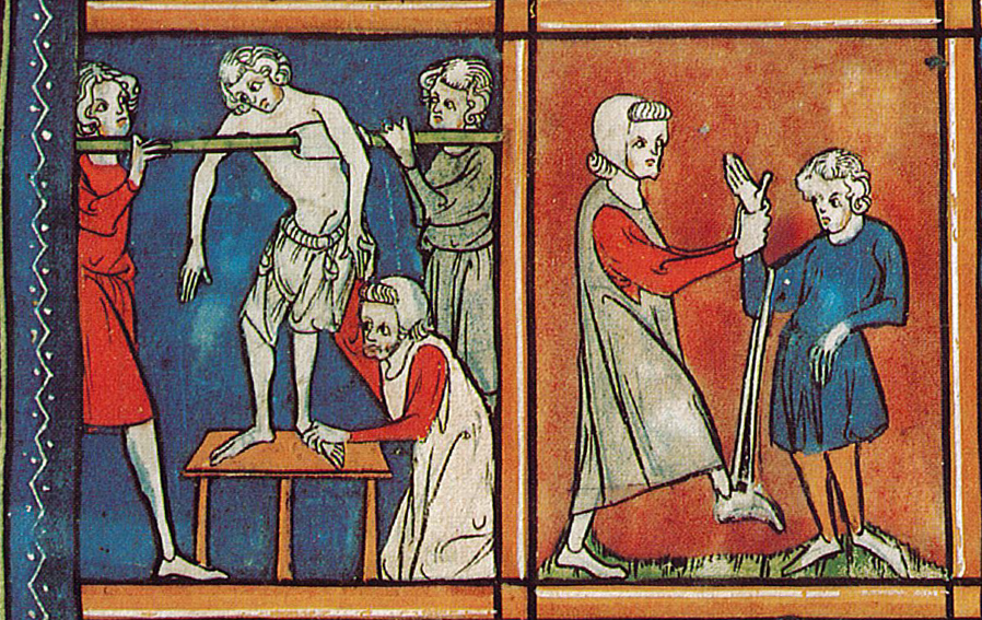 medieval illustration of repairing dislocated joints