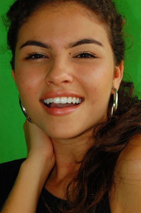 Clareamento Dental