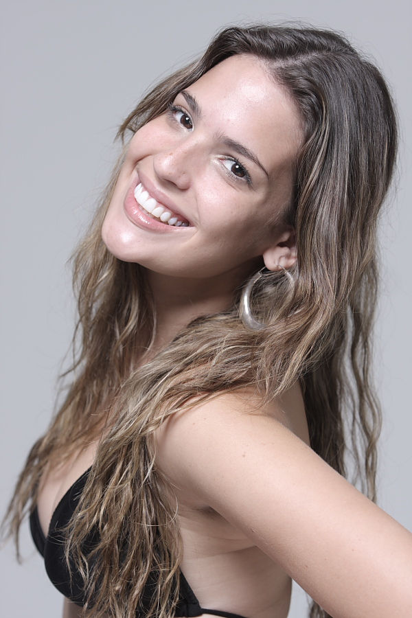 Facetas, Estética