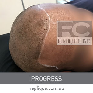 Hair tattoo Brisbane