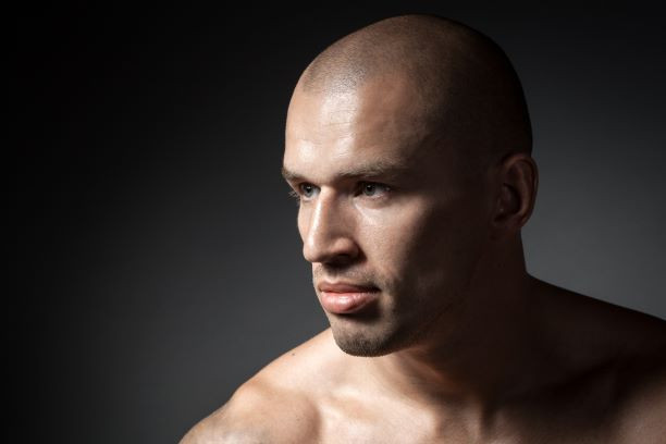 Scalp Micropigmentation Mistakes!