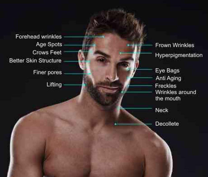 Why Skin Needling is a Huge Leap in the Quest for the Fountain Of Youth