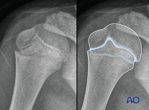 Manuel Ruoss wissenschaftliche und medizinische Illustration Tierwelt Biologie Zoologie pediatric surgery orthopedics humerus
