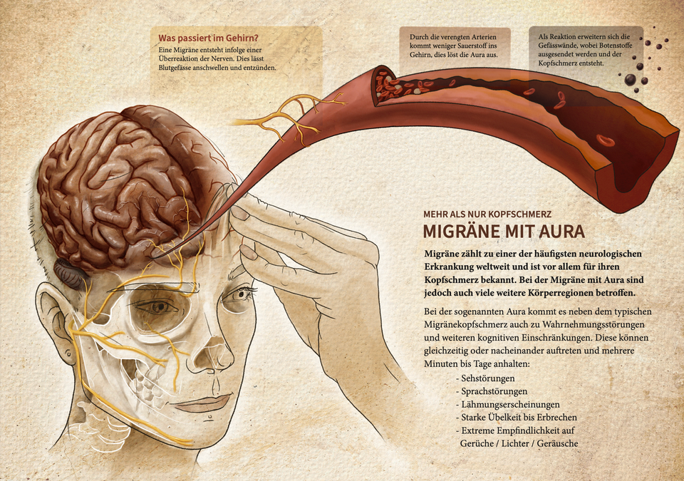 Manuel Ruoss wissenschaftliche und medizinische Illustration Anatomie Chirurgie Tierwelt Biologie Zoologie Migräne Kopfschmerz Aura