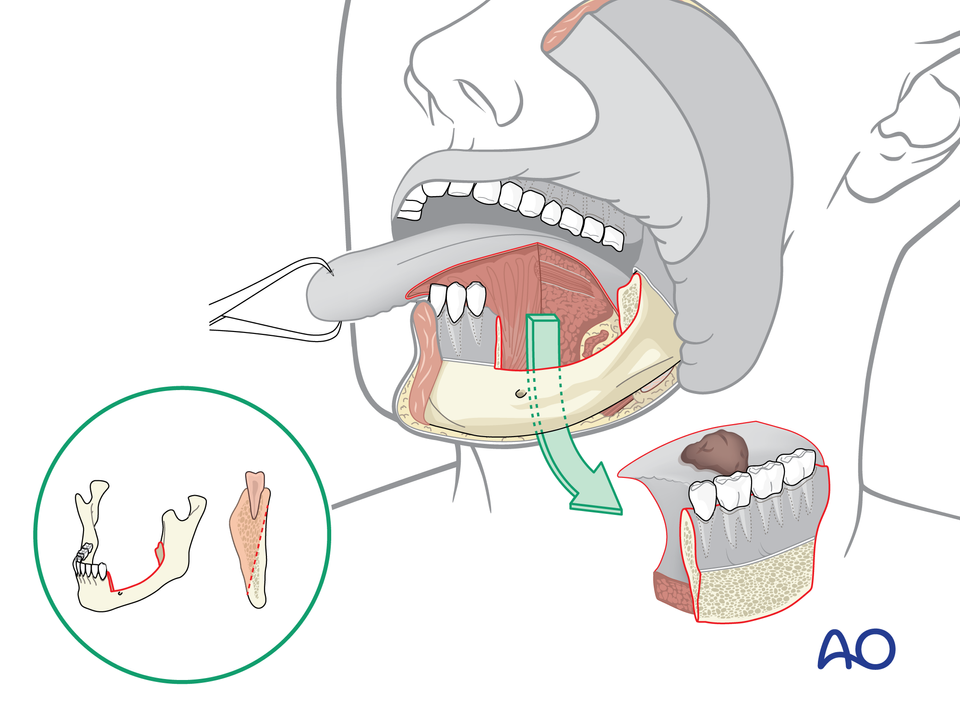 Manuel Ruoss wissenschaftliche und medizinische Illustration Tierwelt Biologie Zoologie oral cancer surgery medicine