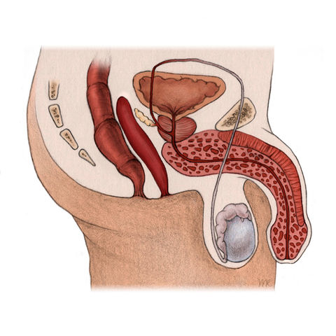 Manuel Ruoss wissenschaftliche scientific medical medizinische Illustration Anatomie Chirurgie Gender Dysphoria Geschlechtsangleichende Operation Trans