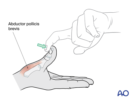 Manuel Ruoss wissenschaftliche und medizinische Illustration Tierwelt Biologie Zoologie hand surgery orthopedics