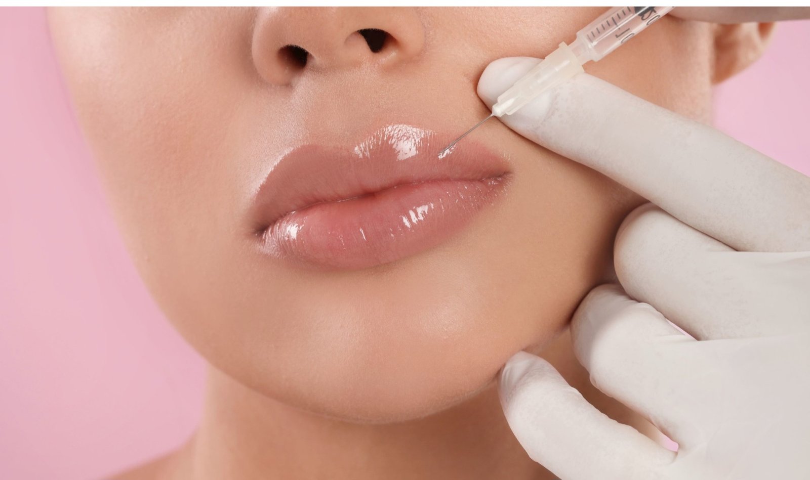 PRP Lip Injection