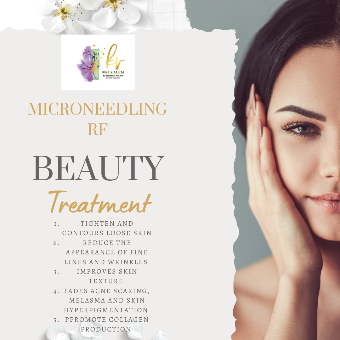 RF Microneedling – Face & Neck