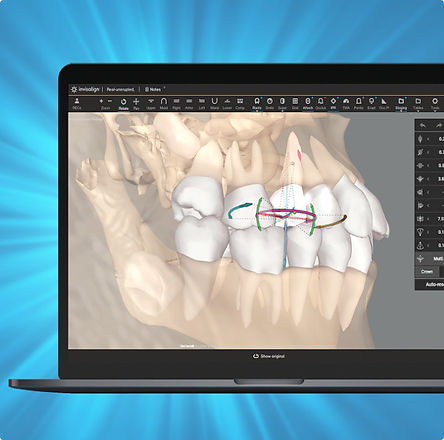 Dr Daniel bouhnik orthodontie saint ouen invisalign.jpeg