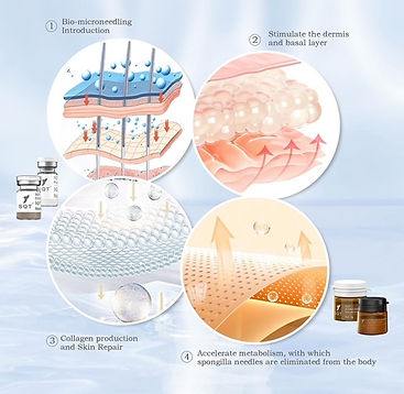 SQT BioMicroneedling