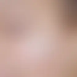 Cilt Bariyeriniz Ne Kadar Hasarlı? (10Soruda Bariyer Check-up)
