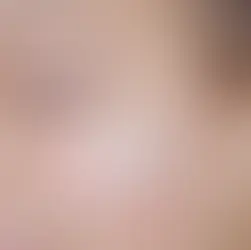 Cilt Bariyeriniz Ne Kadar Hasarlı? (10Soruda Bariyer Check-up)