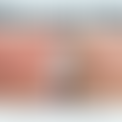 Fraksiyonel Lazer İz Bırakır mı?