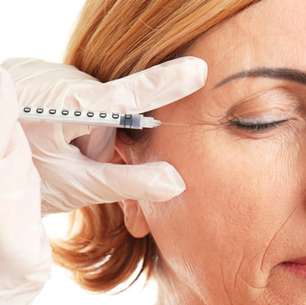 Botoks (Botulinum Toksin) Uygulaması Nedir?