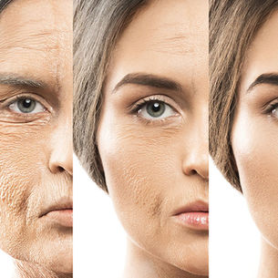 Gençlik İksiri mi, Bilimsel Devrim mi? Somon DNA (PDRN) Tedavisi Nedir?