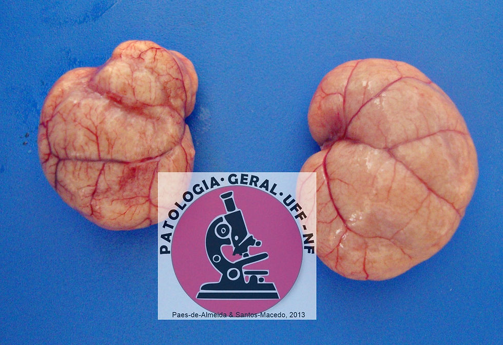 Renal hypotrophy