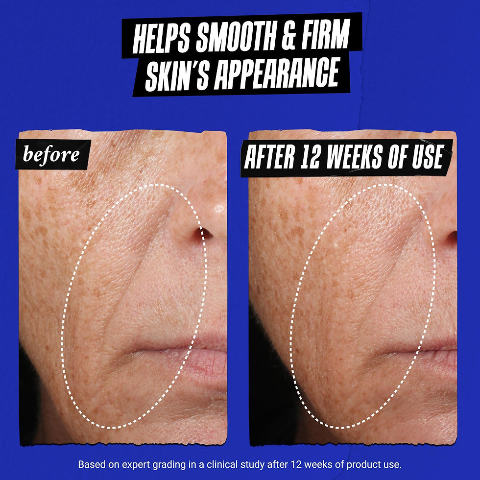 Thumbnail: Kiehl's Midnight Recovery Concentrate Moisturizing Face Oil, Lightweight Faci...