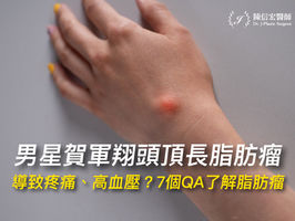 男星賀軍翔頭頂長脂肪瘤導致疼痛、高血壓?7個QA了解脂肪瘤