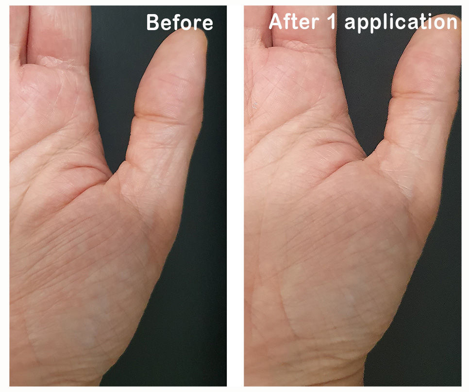 Thumbnail: Sheen's Botanicals Natural Skincare hand lotion with Korean Ginseng before and after use