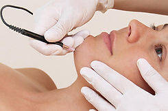 electrolysis-hair-removal.jpeg
