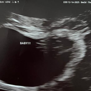 The ultrasound of a baby girl lost to miscarriage