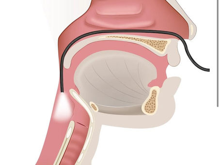 Side-view anatomy diagram of the nasal cavity and throat with a laryngoscope inserted through the nose on a white background