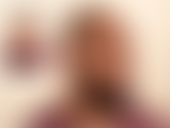 Scalp Pigmentation: Creating a Natural Hair Density Effect, Covering Sparse Scalp Areas