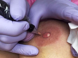 3D Areola Tattoo