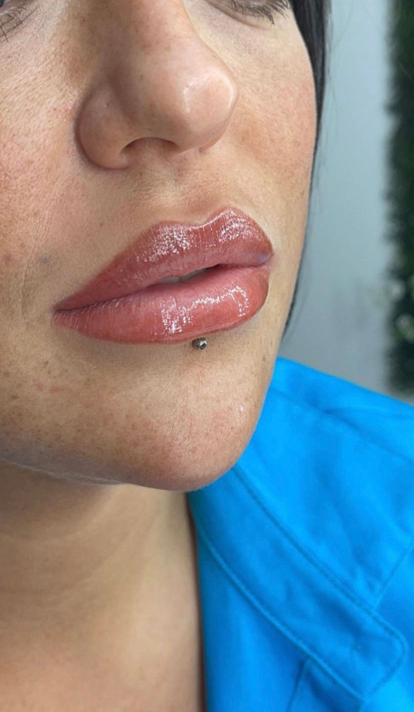 Miniature : Candy lips avec kit complet