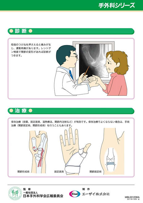 15.母指CM関節症 02.jpg