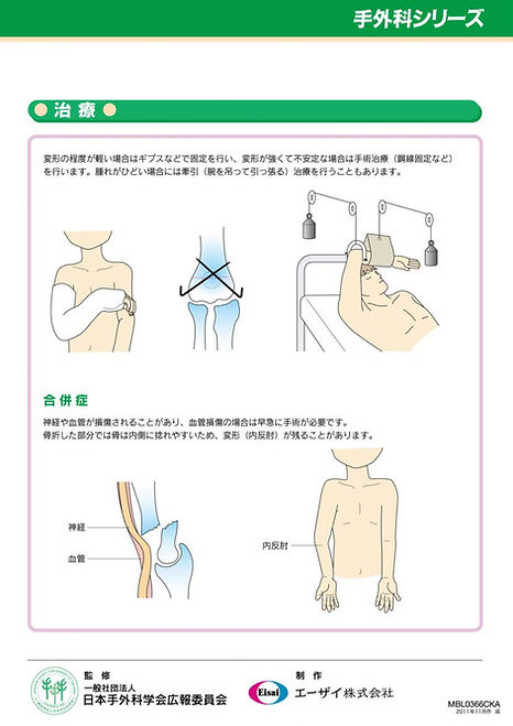 19.上腕骨顆上骨折 02.jpg