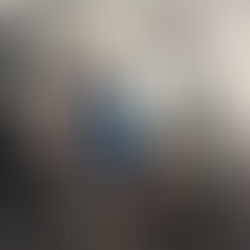 Patellofemoral Pain Syndrome - Also Known As Runner's Knee