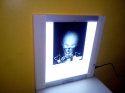Negatoscopio sencillo LED