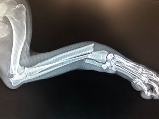 _Boscoe_s broken radius and ulna.jpg