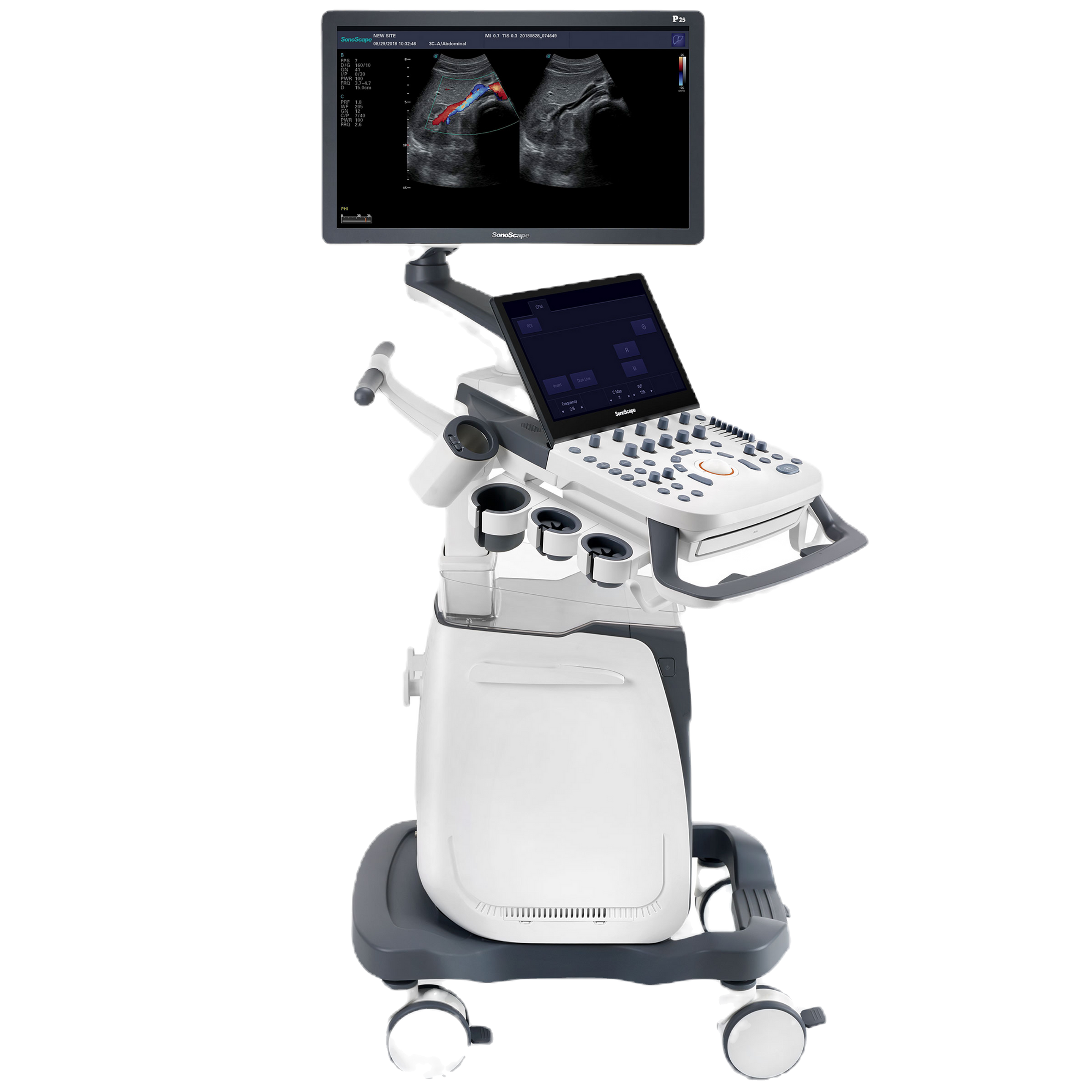 Sonoscape P25 Persistence in Performance