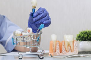 Gloved hand holds a dental implant in a toy shopping cart beside tooth models in a clean dental clinic