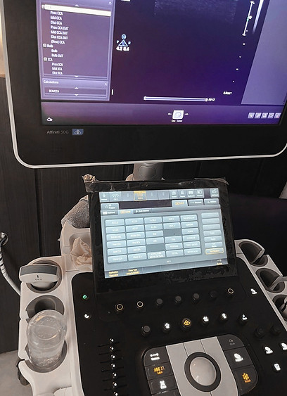 Doppler Vascular Ultrassom Vascular