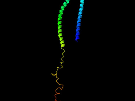 A revelation in our understanding of Parkinson's Disease