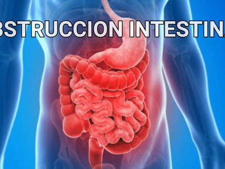 Obstrucción Intestinal - Dra. Debbie Wong