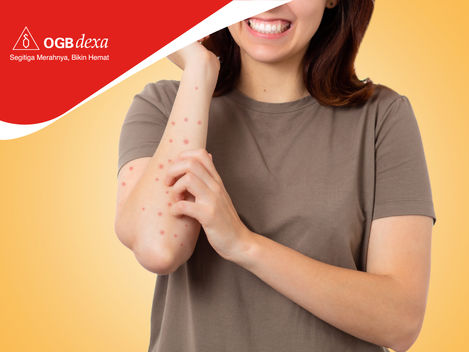 Mengenal Skabies: Penyakit Kulit Akibat Kutu yang Membuat Liang di Dalam Kulit