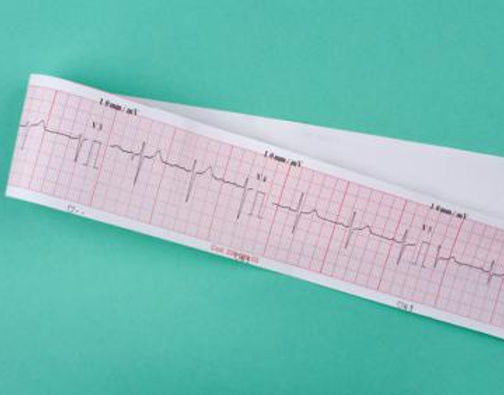 EKG.jpg